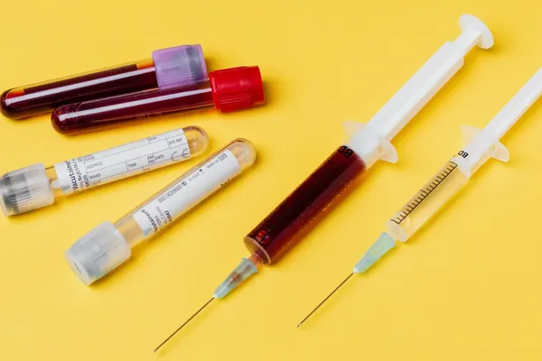 Blood Test Detects Heart Failure in Diabetes Patients