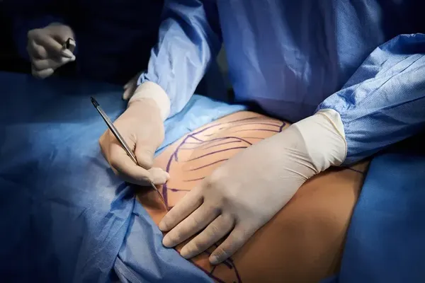 California Plastic Surgery Chains Face New Warnings