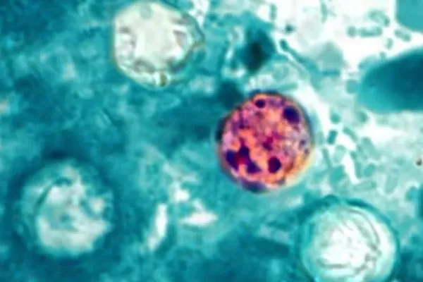 Cyclospora Cases Climb as Former FDA Official Seeks Independent Review