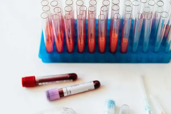Small Study Finds Epigenetic Signal for Progestin Response
