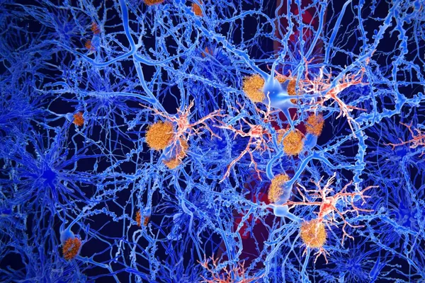 Experimental Molecule Reprograms Brain Immune Cells in Alzheimer’s Models