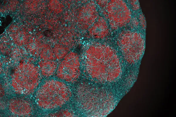 Sildenafil Shows Early Signals in Six Leigh Syndrome Patients