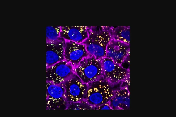 New Nanoparticles Kill Tumors and Prevent Muscle Wasting