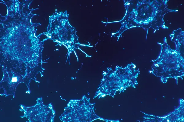 PRC2 Cancer Research Targets the Proteins That Control Cell Memory