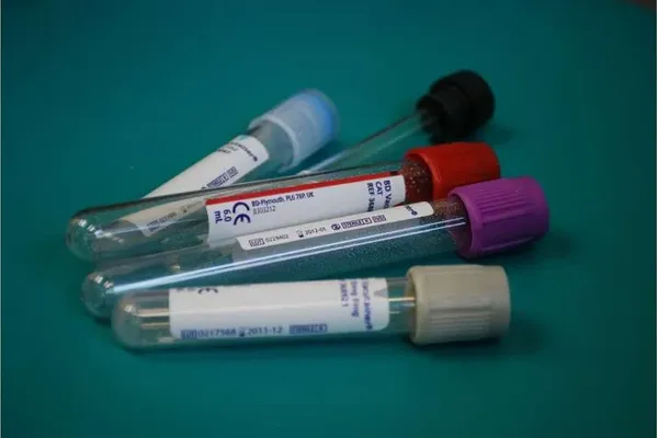 Rifampicin Study Shows PXR Can Raise Hormone Carrier