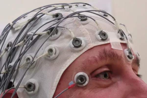 Epilepsy Death Demand Exposes Gaps in Risk Communication