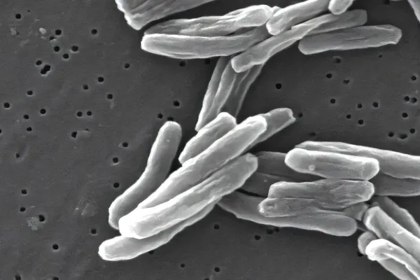 UC Davis Researchers Develop Faster Tuberculosis Blood Test
